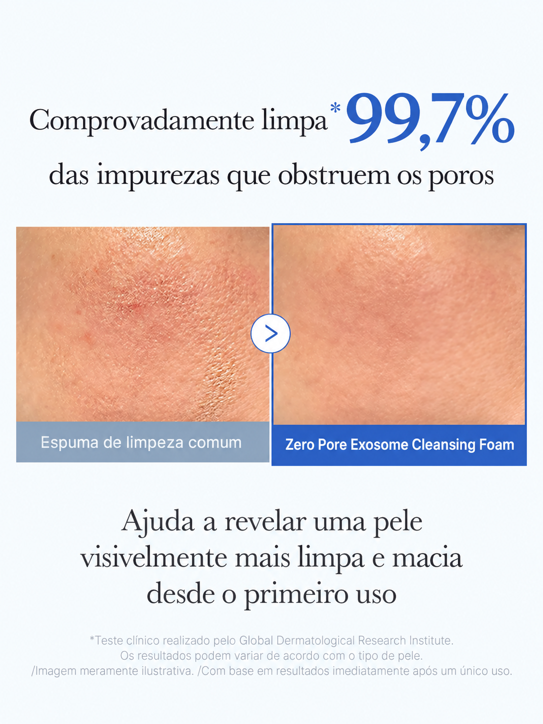 Medicube Zero Pore Espuma de Limpeza com Cápsulas de Exossomas 120g